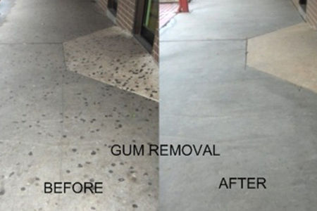 Gum removal